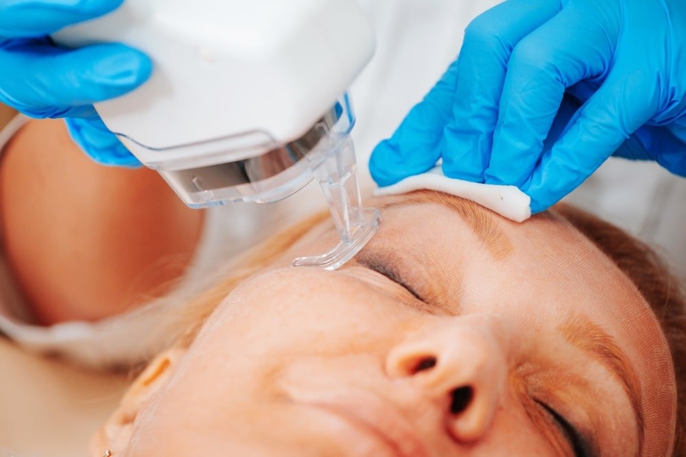 Fractional,Laser,Resurfacing,Is,A,Unique,Technique,For,Skin,Rejuvenation