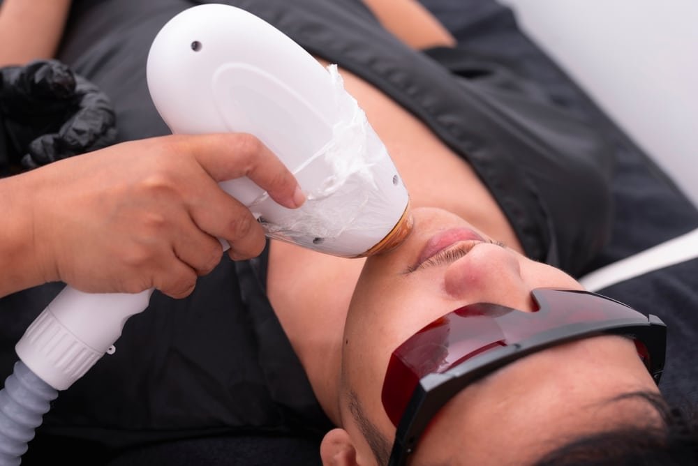 Diode,Ice,Laser,Hair,Removal,Procedure,At,An,Aesthetic,Clinic.